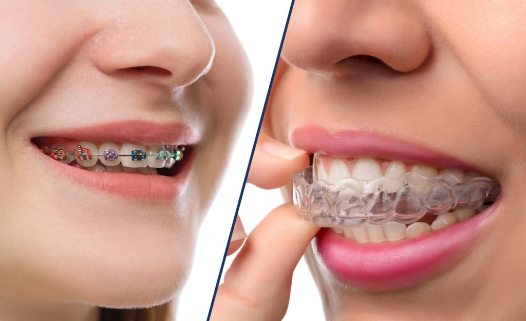 Antes e depois - Ortodontia
